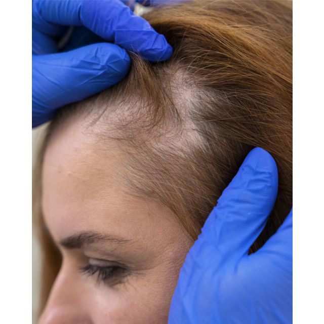 Scalp Micropigmentation Certification Course June 9 & 10, 2026